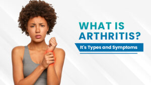 Read more about the article What is arthritis? It’s Types and Symptoms