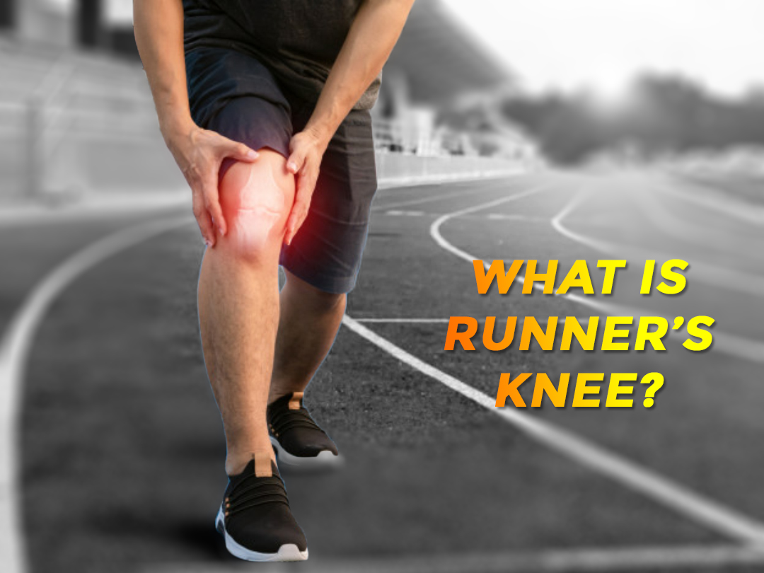 Read more about the article What Is Runner’s Knee? Signs, Symptoms and Treatment