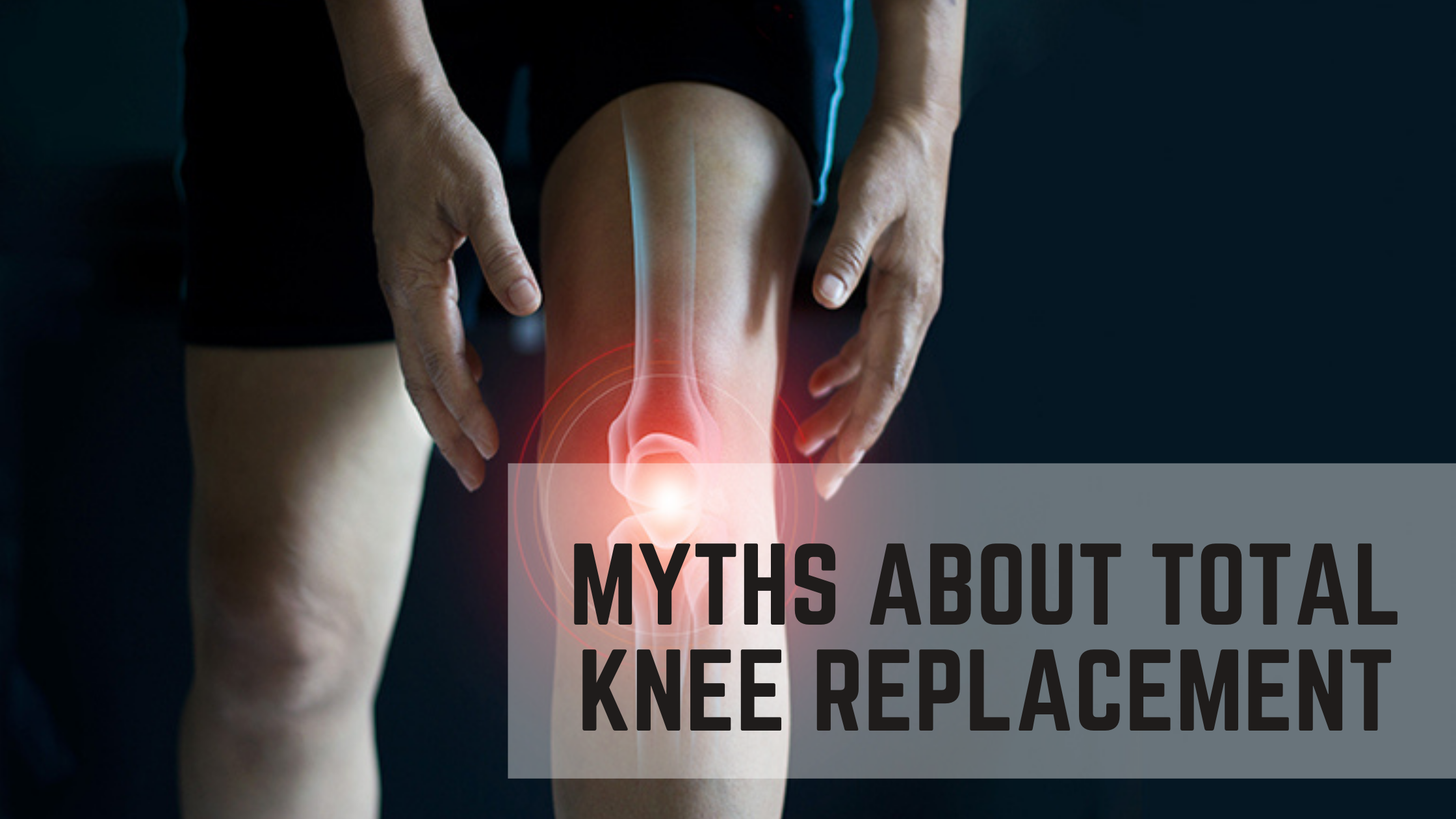 You are currently viewing Myths about Total Knee Replacement