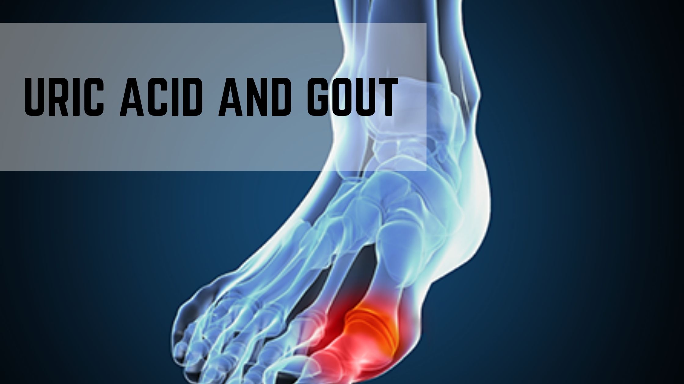 You are currently viewing Uric Acid And Gout