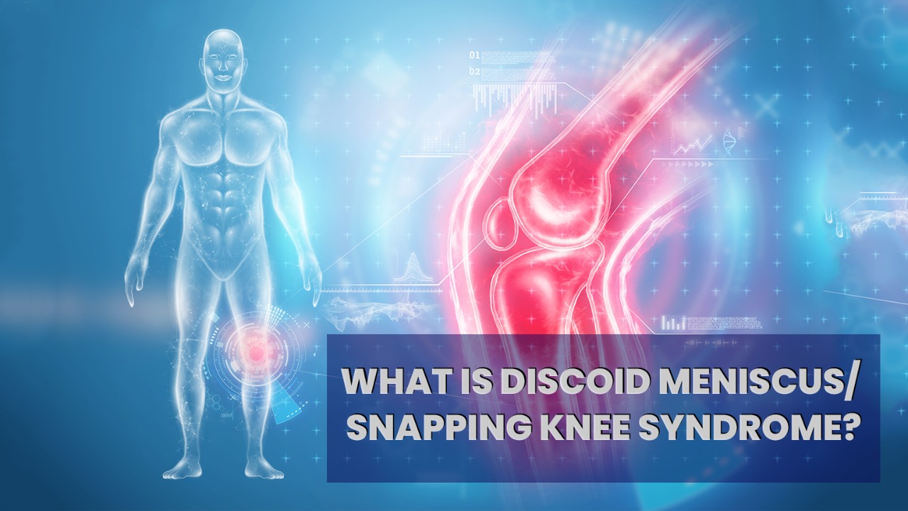 Read more about the article Discoid Meniscus/ Snapping Knee Syndrome