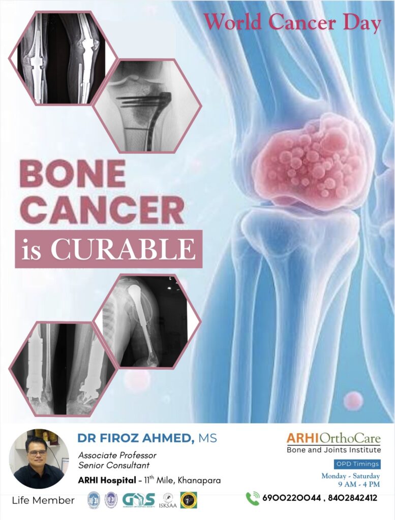 world cancer day bone cancer