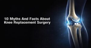 Knee replacement myths and facts explained by Dr Firoz Ahmed Guwahati