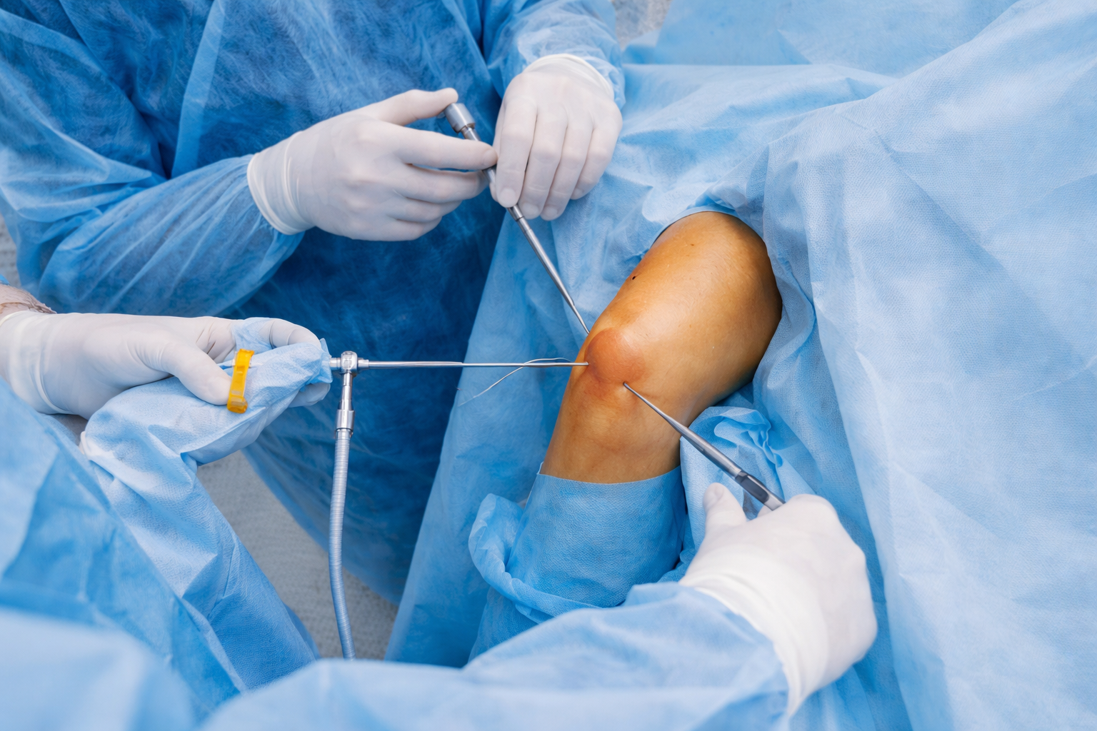 knee arthroscopy minimally invasive guwahati dr firoz ahmed